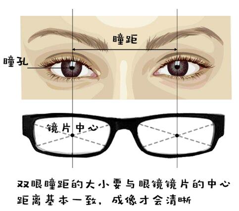 你的眼镜过期了吗？荆门医学验光配镜提醒您赶快检查!