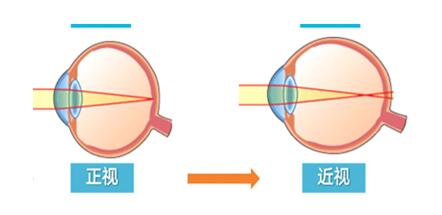 荆门医学验光配镜|每双近视的眼睛，都有自己的“灵魂伴侣”