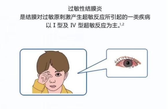 荆门爱尔眼科医院丨秋季如何应对过敏性结膜炎？