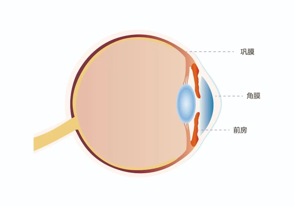 荆门爱尔眼科医院科普丨什么是角膜移植？